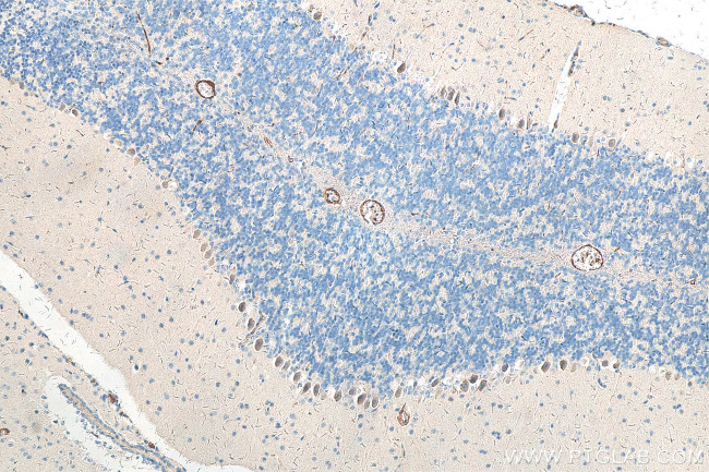 DHX35 Antibody in Immunohistochemistry (Paraffin) (IHC (P))