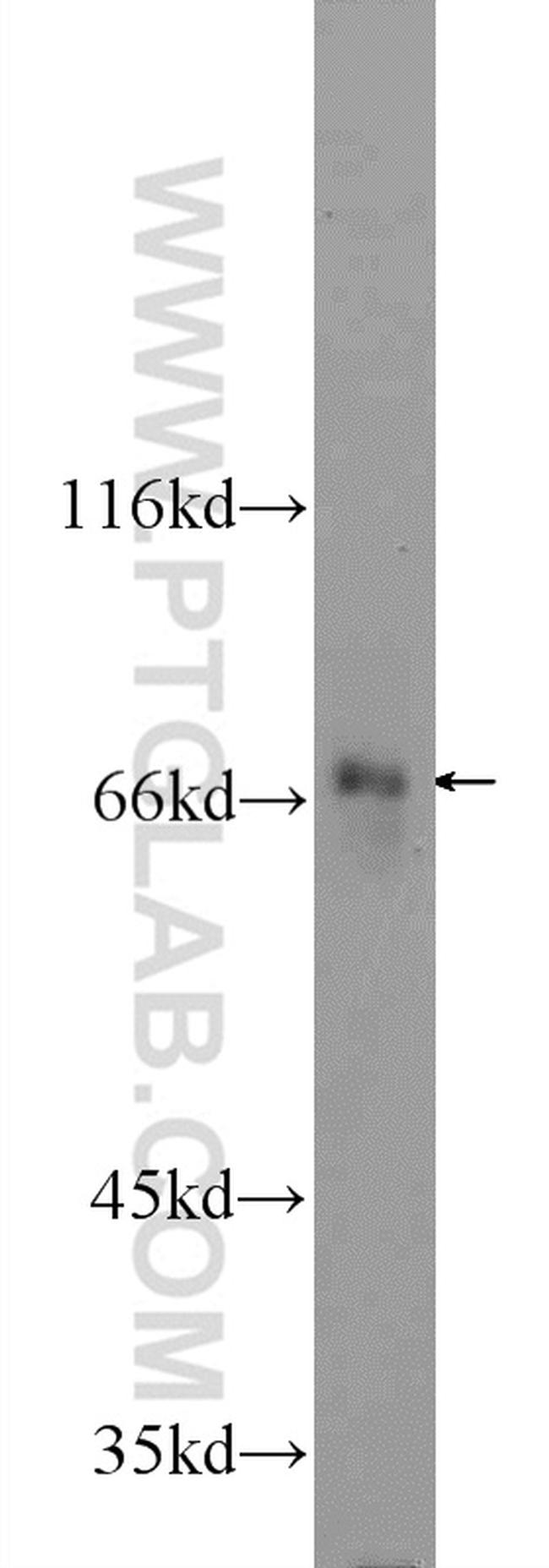 DHX35 Antibody in Western Blot (WB)
