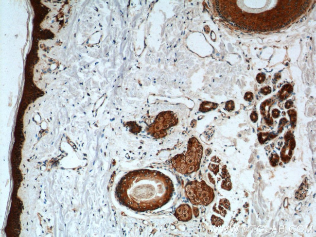 ST3GAL3 Antibody in Immunohistochemistry (Paraffin) (IHC (P))