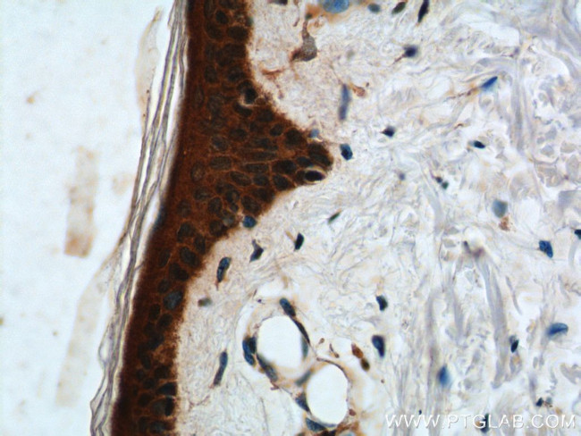 ST3GAL3 Antibody in Immunohistochemistry (Paraffin) (IHC (P))