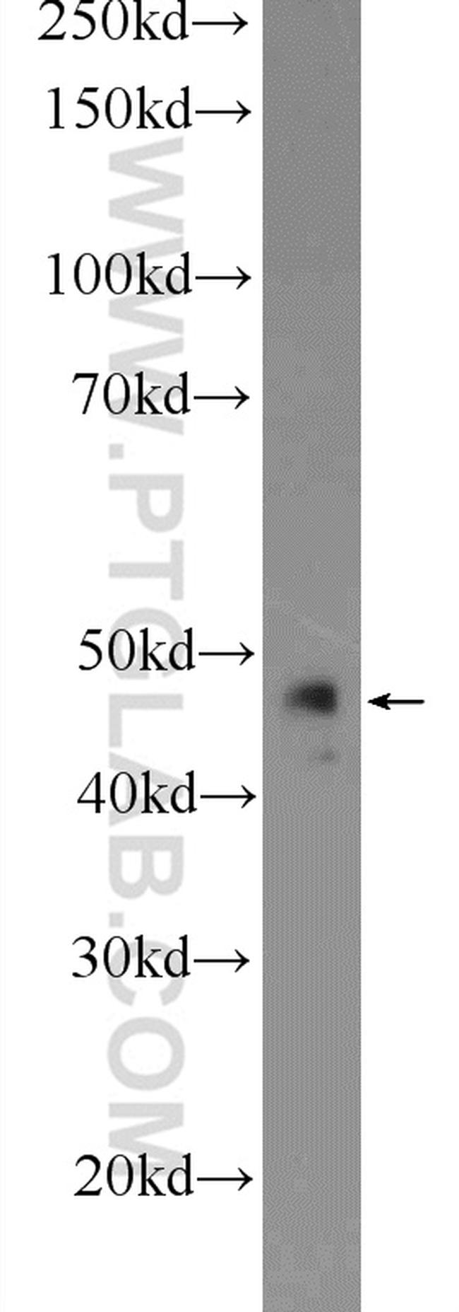 ST3GAL3 Antibody in Western Blot (WB)