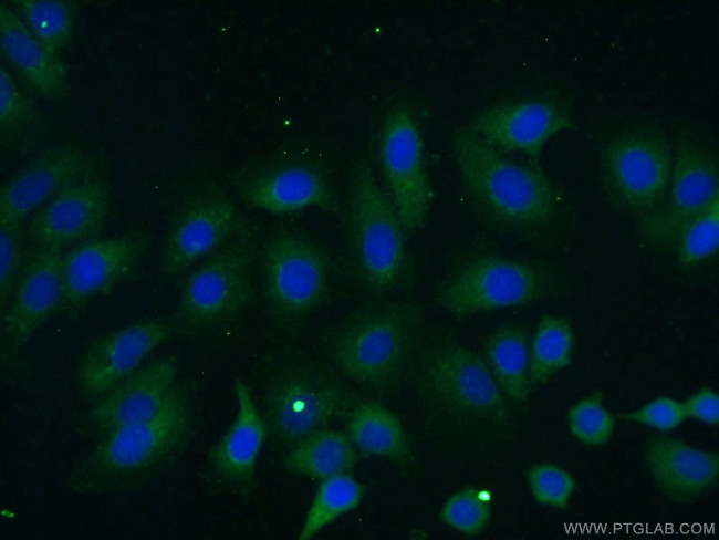 ILK Antibody in Immunocytochemistry (ICC/IF)