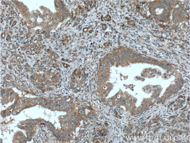 ILK Antibody in Immunohistochemistry (Paraffin) (IHC (P))