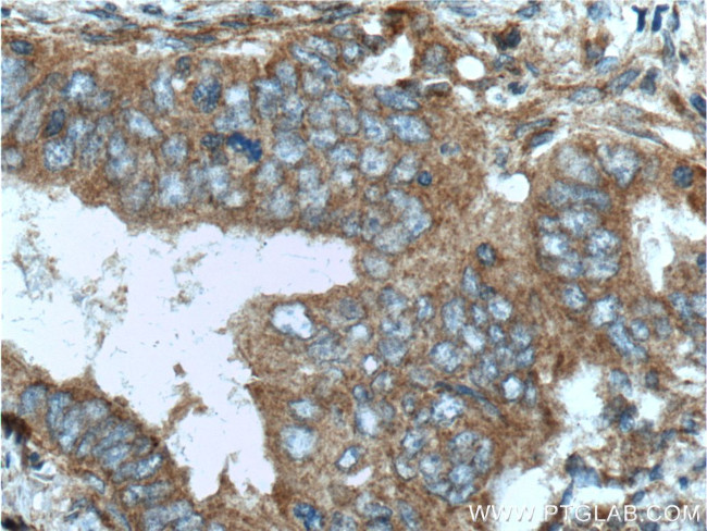 ILK Antibody in Immunohistochemistry (Paraffin) (IHC (P))