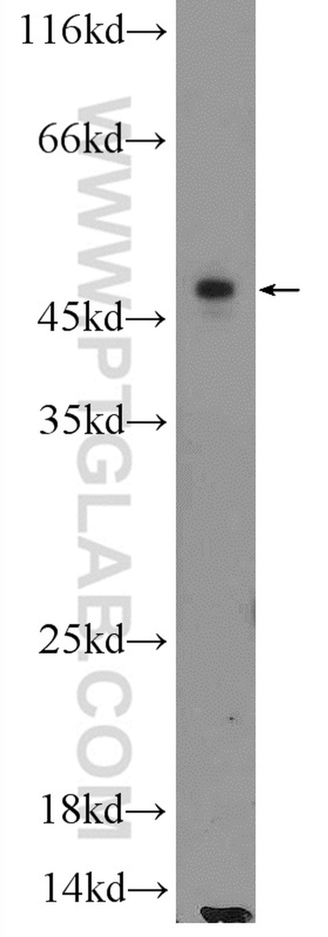 ILK Antibody in Western Blot (WB)