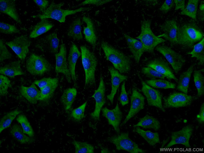 ADAMTS12 Antibody in Immunocytochemistry (ICC/IF)