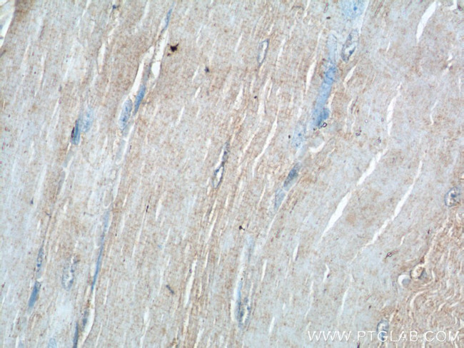 ADAMTS12 Antibody in Immunohistochemistry (Paraffin) (IHC (P))