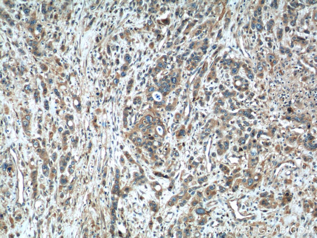 ADAMTS12 Antibody in Immunohistochemistry (Paraffin) (IHC (P))