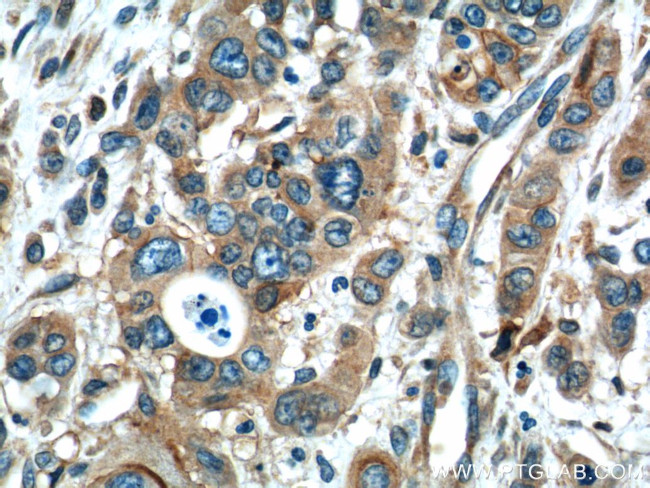 ADAMTS12 Antibody in Immunohistochemistry (Paraffin) (IHC (P))