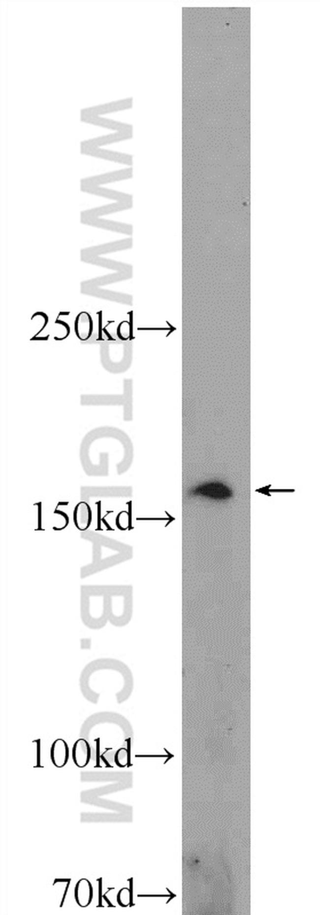 ADAMTS12 Antibody in Western Blot (WB)