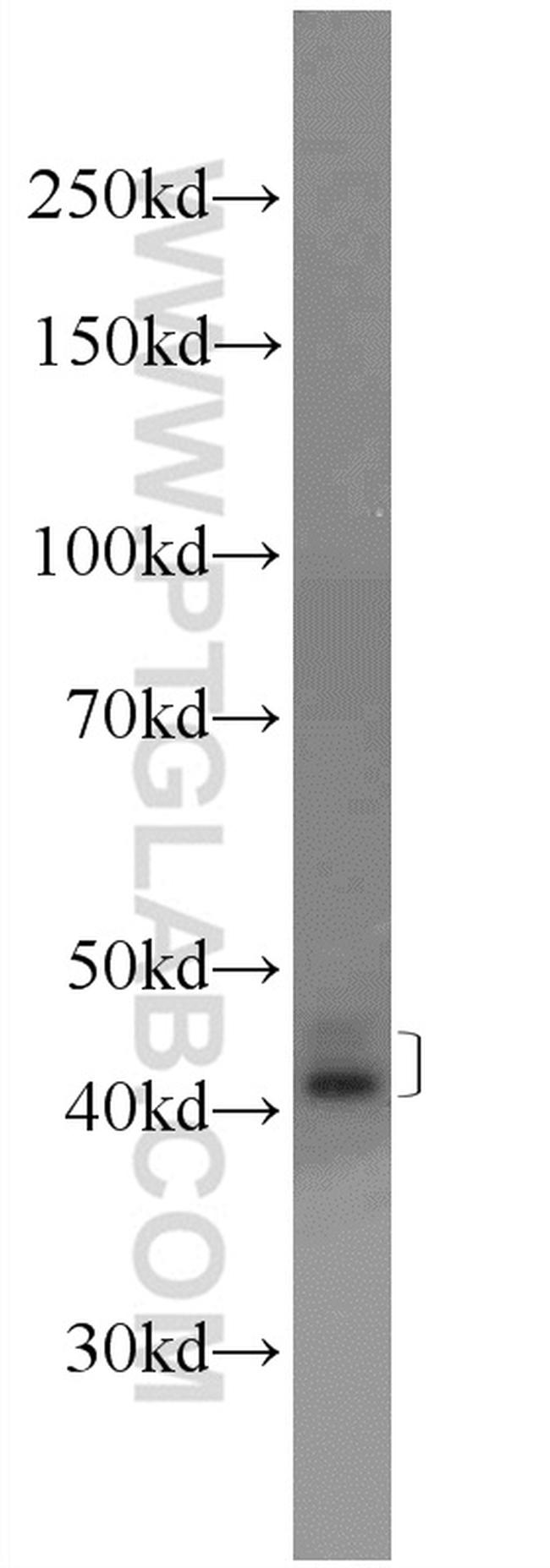 SCCPDH Antibody in Western Blot (WB)