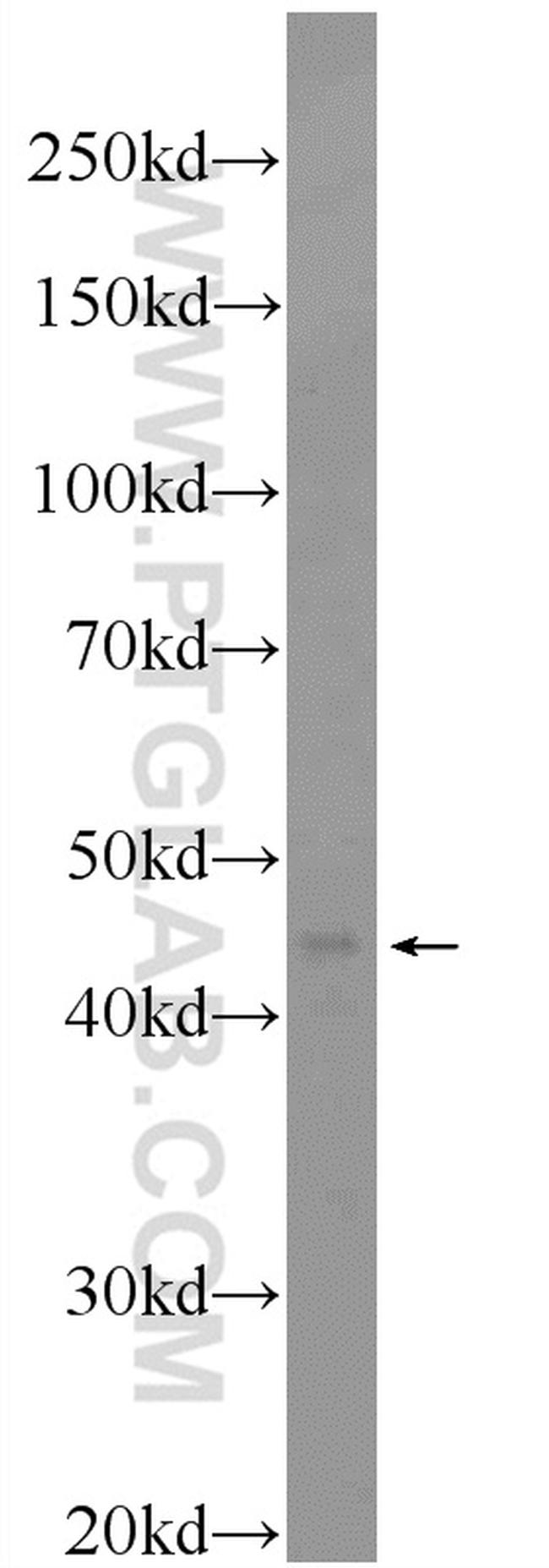 SCCPDH Antibody in Western Blot (WB)