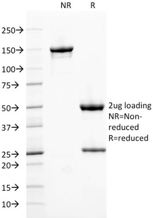 Ferritin, Heavy Chain (FTH) Antibody in SDS-PAGE (SDS-PAGE)