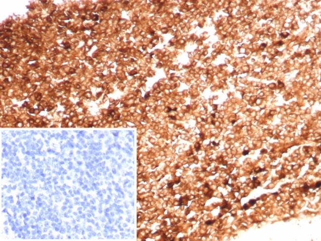 Ferritin, Heavy Chain (FTH) (Microglia Marker) Antibody in Immunohistochemistry (Paraffin) (IHC (P))