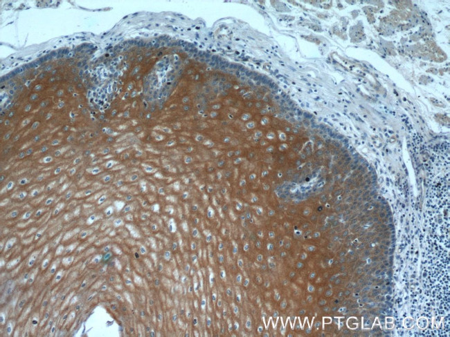 LCE1A Antibody in Immunohistochemistry (Paraffin) (IHC (P))