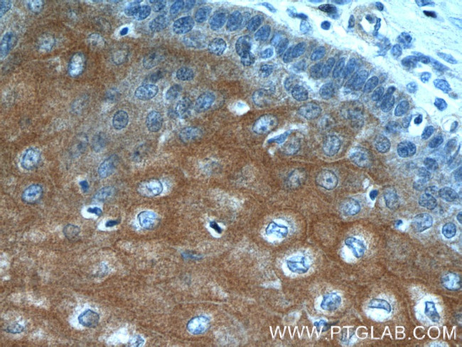 LCE1A Antibody in Immunohistochemistry (Paraffin) (IHC (P))