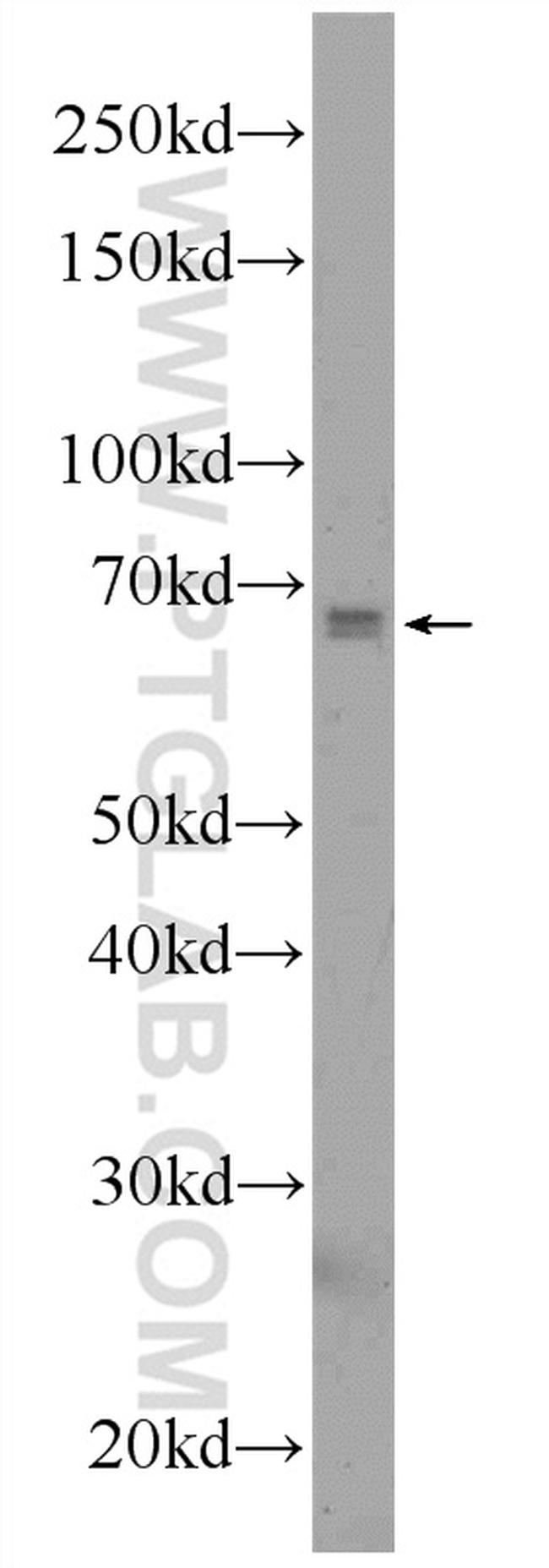 C6orf182 Antibody in Western Blot (WB)