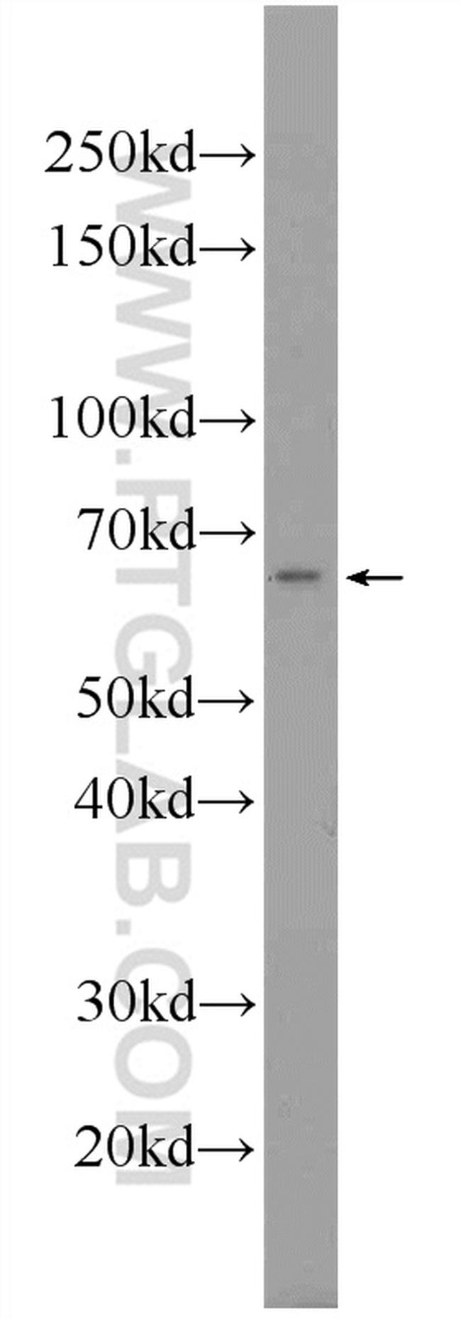 C6orf182 Antibody in Western Blot (WB)