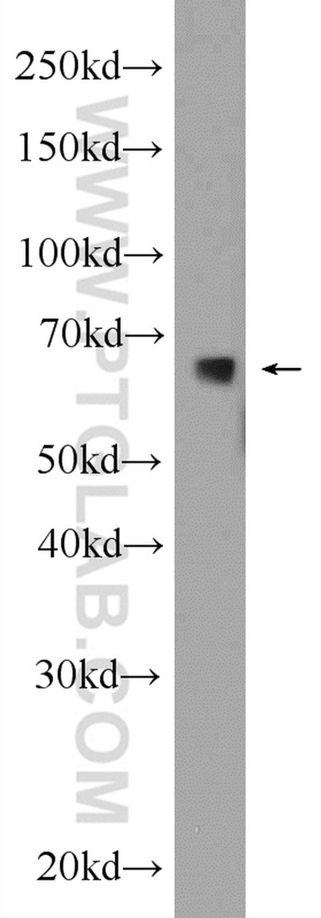 C6orf182 Antibody in Western Blot (WB)