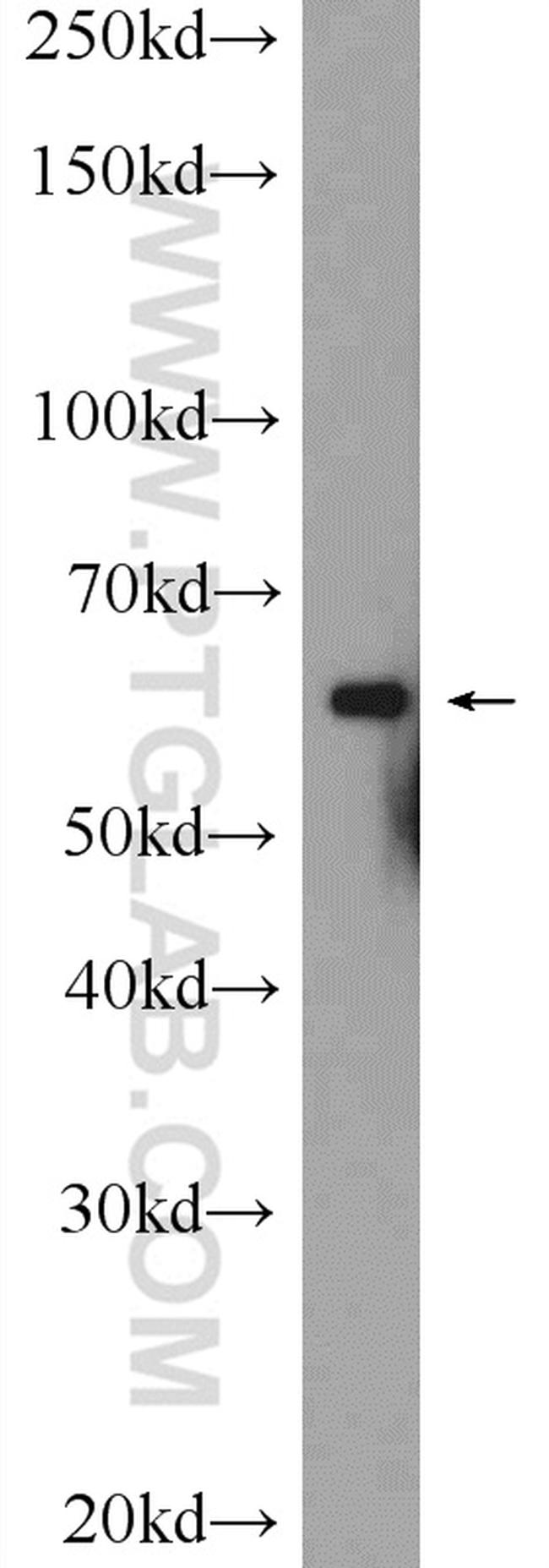 C6orf182 Antibody in Western Blot (WB)