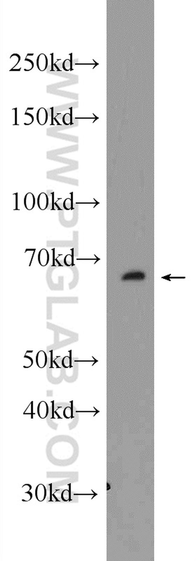 C6orf182 Antibody in Western Blot (WB)