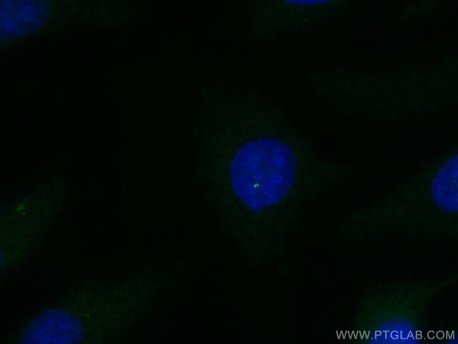 C6orf182 Antibody in Immunocytochemistry (ICC/IF)