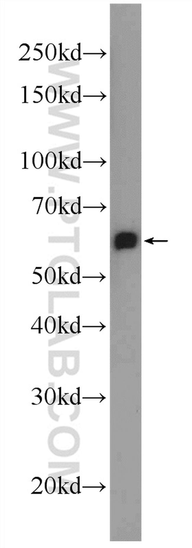 C6orf182 Antibody in Western Blot (WB)