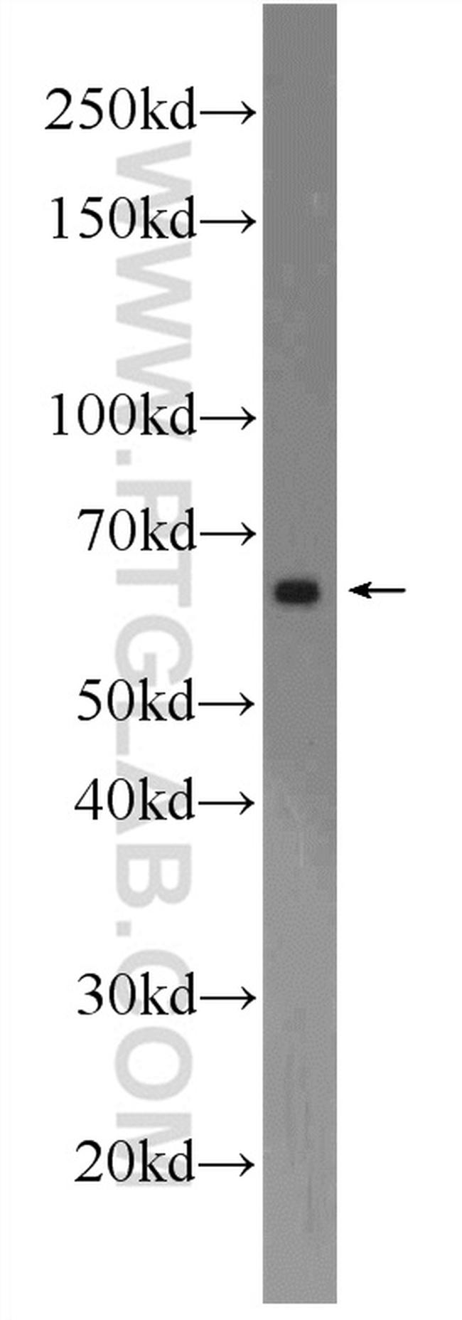 C6orf182 Antibody in Western Blot (WB)