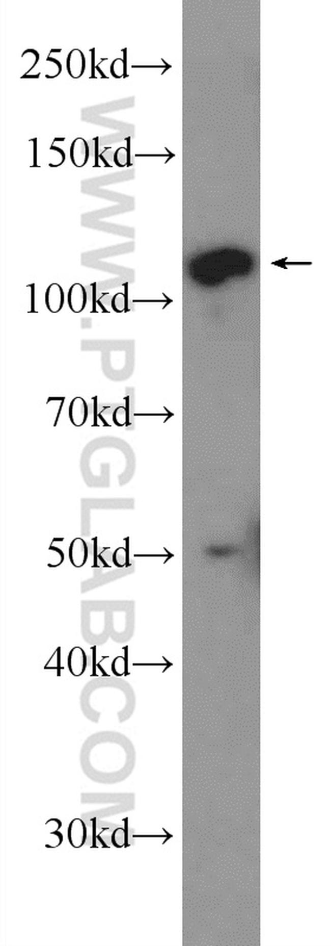 C10orf28 Antibody in Western Blot (WB)