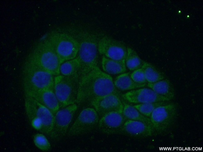 C18orf21 Antibody in Immunocytochemistry (ICC/IF)