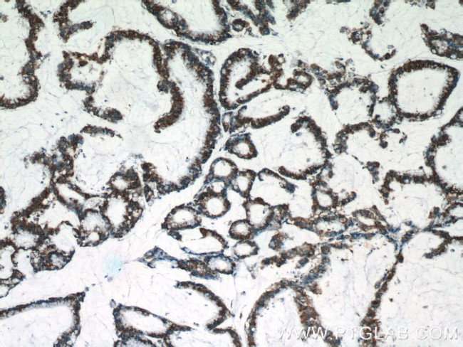 C18orf21 Antibody in Immunohistochemistry (Paraffin) (IHC (P))