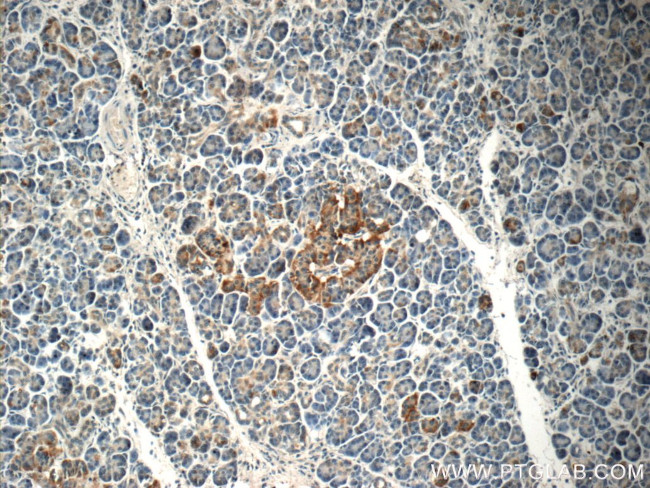 C18orf21 Antibody in Immunohistochemistry (Paraffin) (IHC (P))