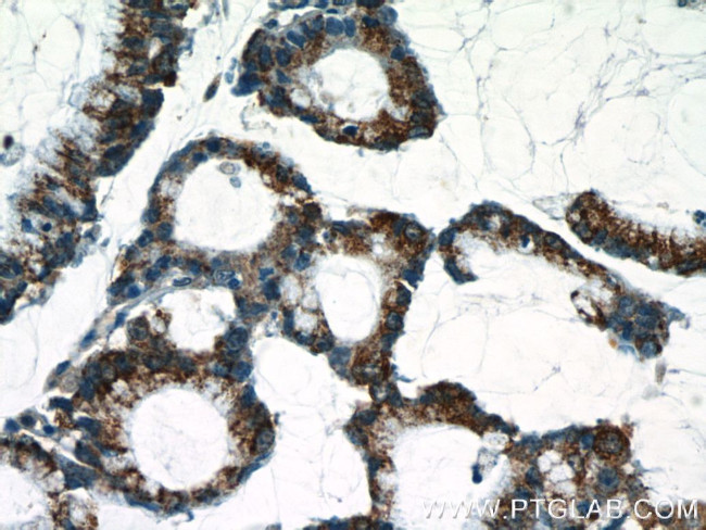 C18orf21 Antibody in Immunohistochemistry (Paraffin) (IHC (P))