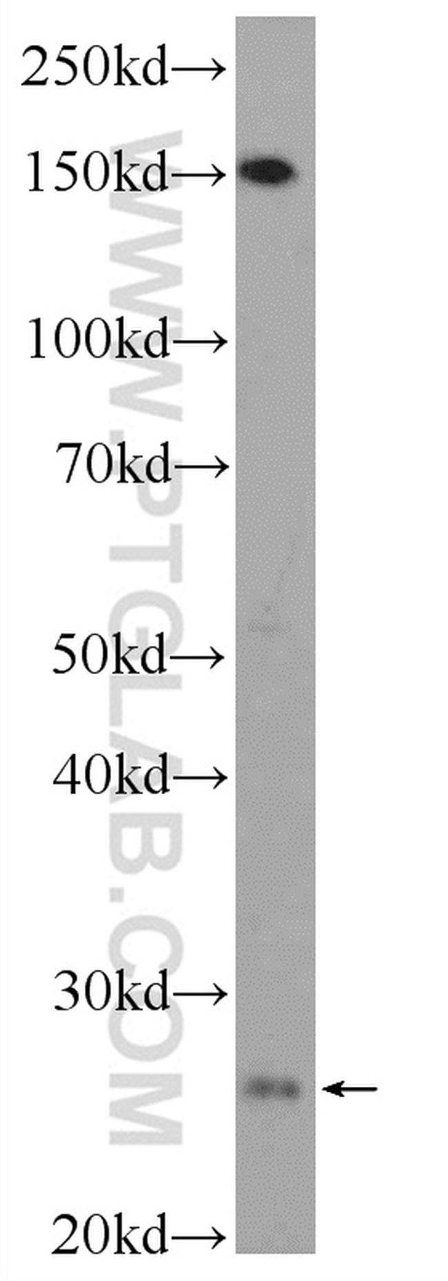 C18orf21 Antibody in Western Blot (WB)