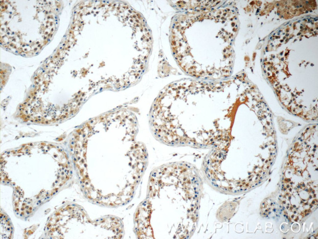 FDXACB1 Antibody in Immunohistochemistry (Paraffin) (IHC (P))