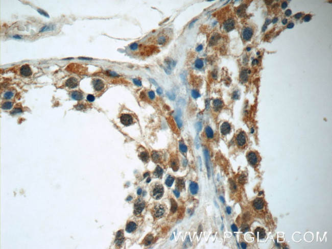 FDXACB1 Antibody in Immunohistochemistry (Paraffin) (IHC (P))