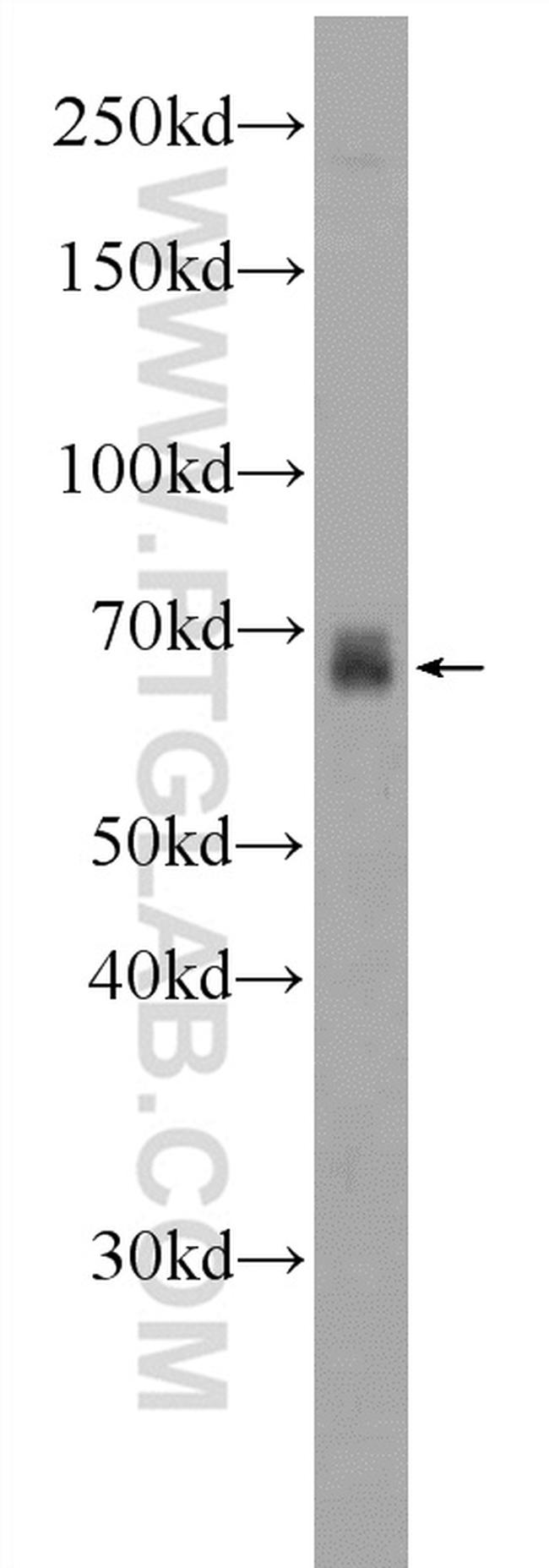 FDXACB1 Antibody in Western Blot (WB)