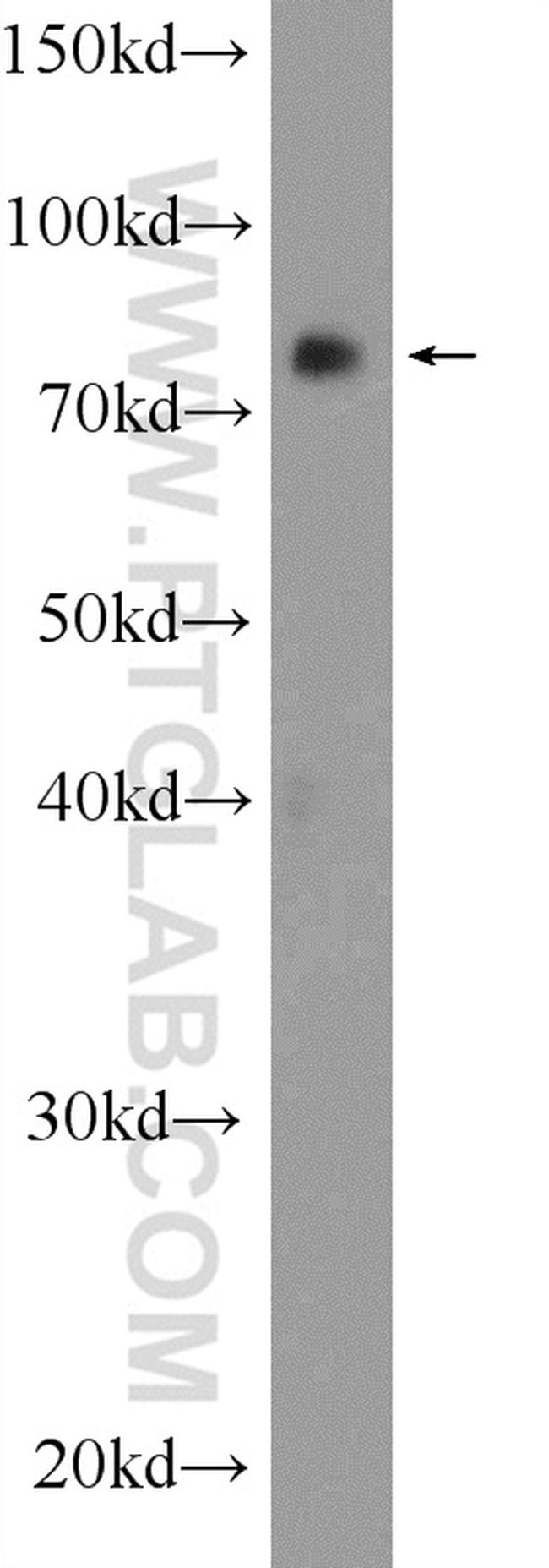 RNF219 Antibody in Western Blot (WB)