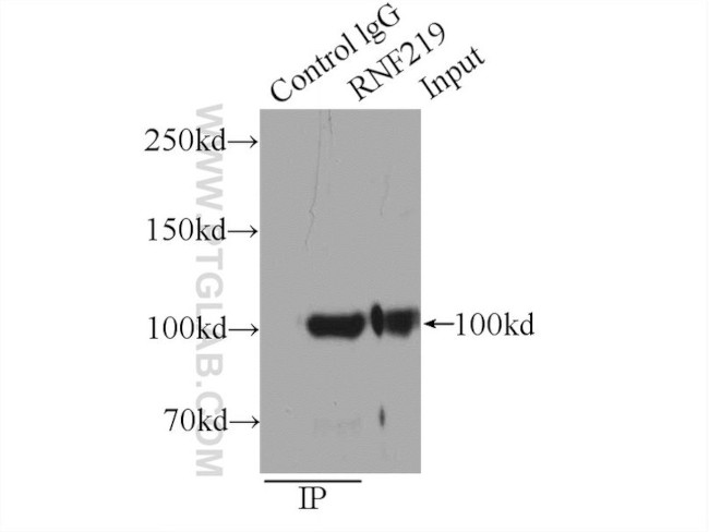 RNF219 Antibody in Immunoprecipitation (IP)