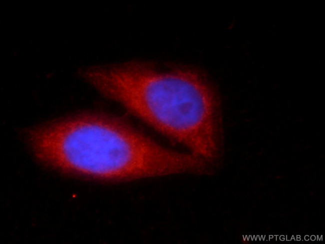 KHDC3L Antibody in Immunocytochemistry (ICC/IF)