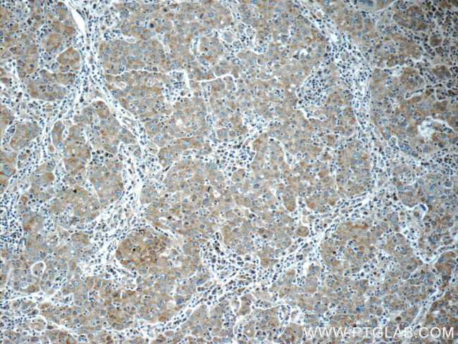 KHDC3L Antibody in Immunohistochemistry (Paraffin) (IHC (P))