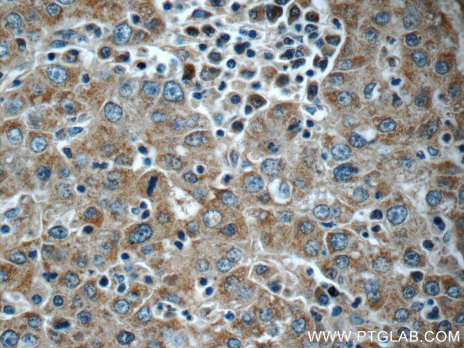 KHDC3L Antibody in Immunohistochemistry (Paraffin) (IHC (P))