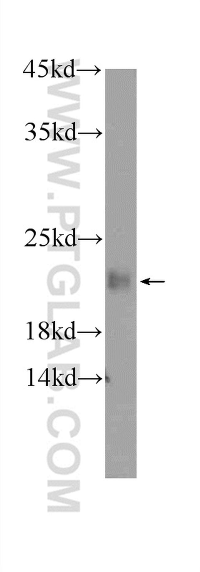 KHDC3L Antibody in Western Blot (WB)