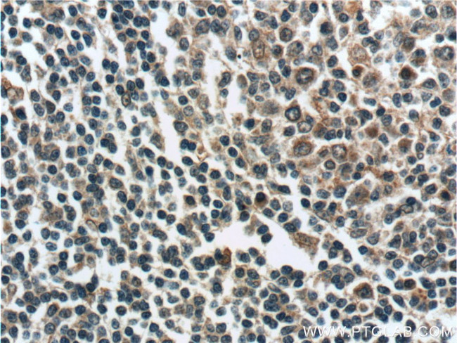 ZC3H12D Antibody in Immunohistochemistry (Paraffin) (IHC (P))