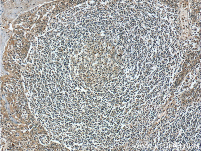 ZC3H12D Antibody in Immunohistochemistry (Paraffin) (IHC (P))