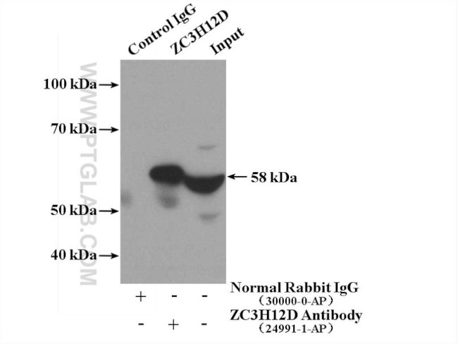 ZC3H12D Antibody in Immunoprecipitation (IP)