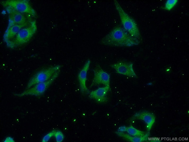 HuD Antibody in Immunocytochemistry (ICC/IF)