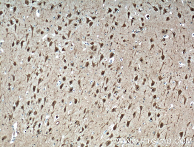 HuD Antibody in Immunohistochemistry (Paraffin) (IHC (P))