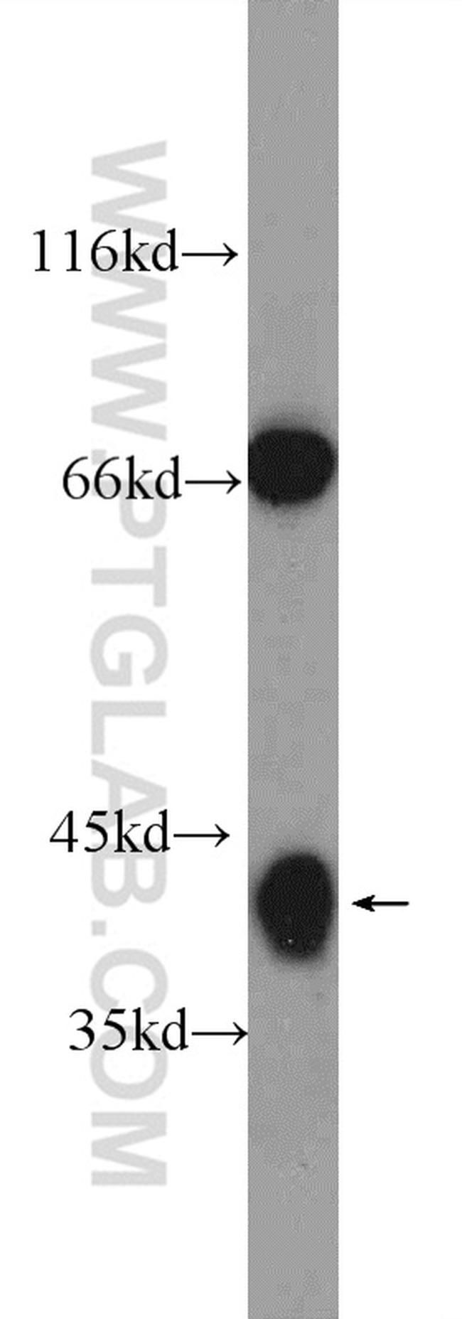 HuD Antibody in Western Blot (WB)