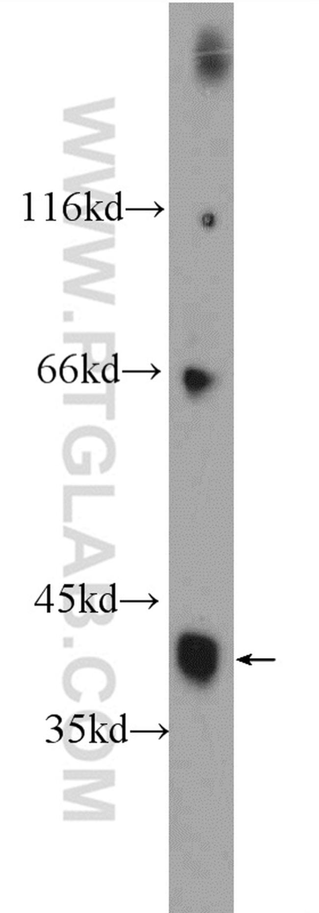 HuD Antibody in Western Blot (WB)